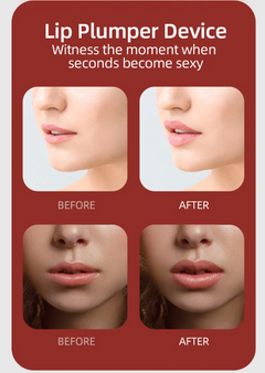 Silicone Lip Enhancer